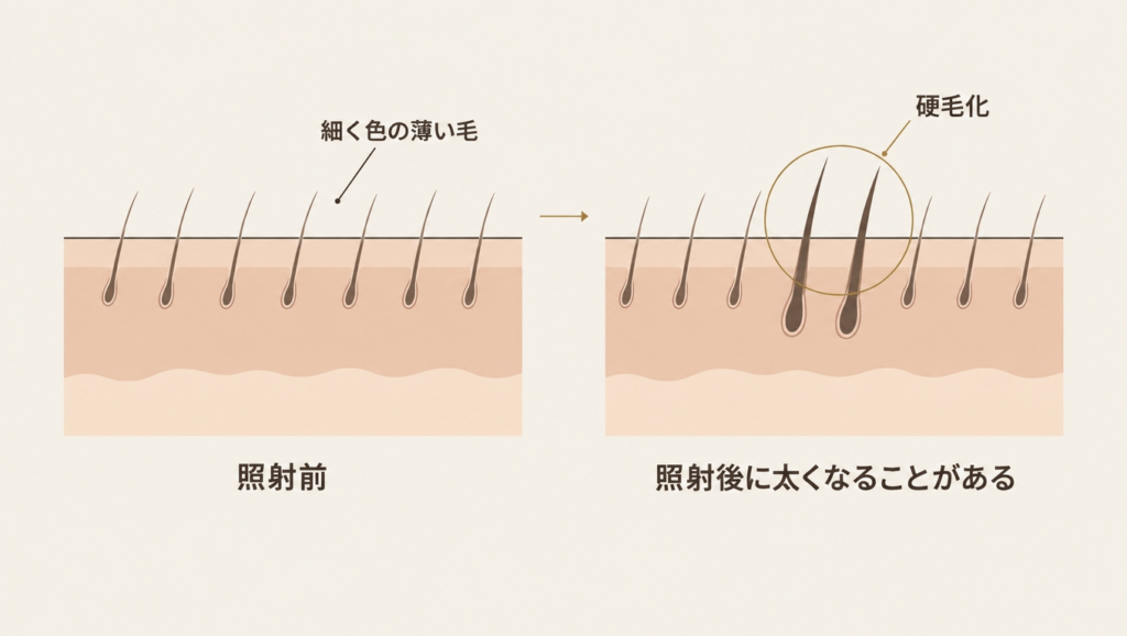 細い毛が太く長くなる硬毛化のイメージ図