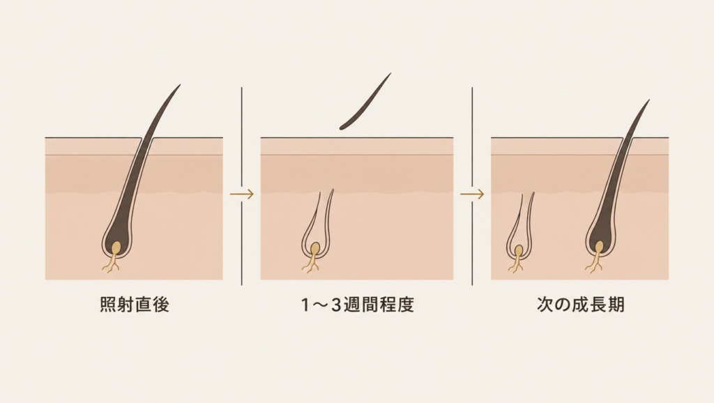照射直後、毛が抜け落ちる時期、別の毛が成長してくる時期の経過